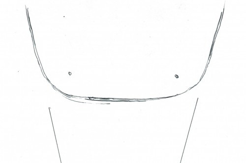 Scan