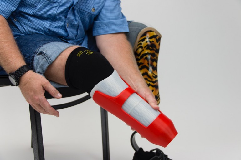 Resultado de imagen para 3d printed prosthetics